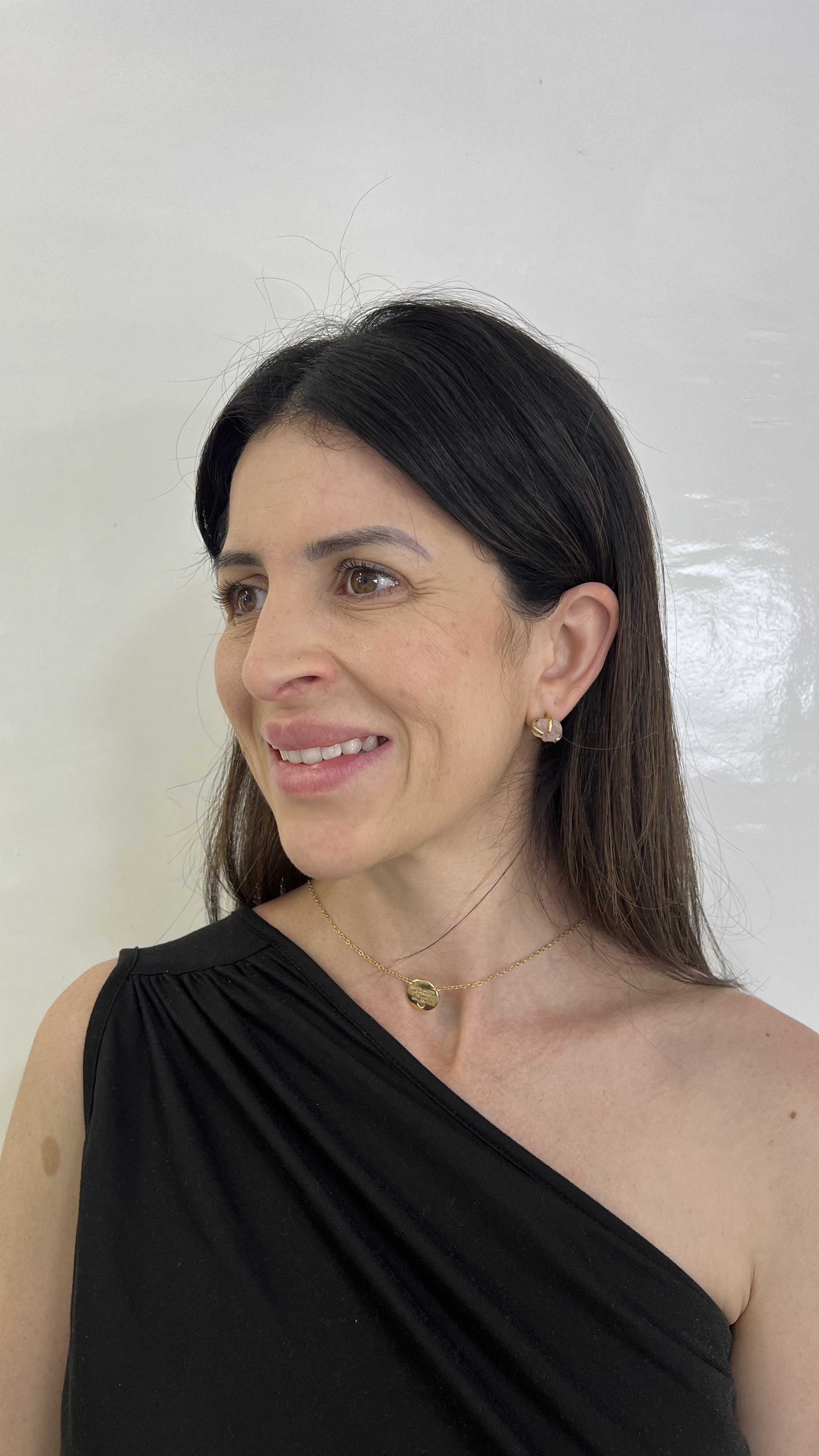 Rita antes do tratamento - lado direito sorrindo
